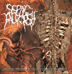 Download Septic Autopsy - Spontaneous Emanation Of Rotting Smell Through Necropsy Process