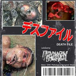Download Traumatic Brain Injury - Death File