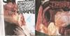 last ned album Enterorrhagia Infester - Crash Course Lobotomy Autoimmune Lymphoproliferative Syndrome Infestsepsia