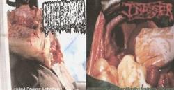 Download Enterorrhagia Infester - Crash Course Lobotomy Autoimmune Lymphoproliferative Syndrome Infestsepsia