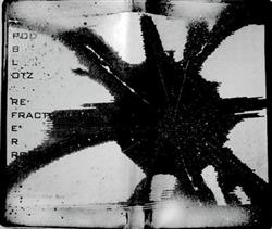 Download Pod Blotz - Refractive Errors