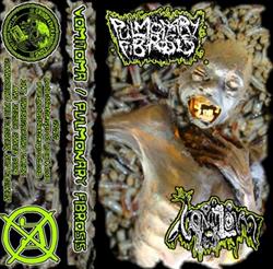 Download Vomitoma Pulmonary Fibrosis - Vomitoma Pulmonary Fibrosis