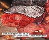 online anhören Biliary Cirrhosis - Intrahepatic Bile Ductules Obstruction