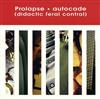 descargar álbum Prolapse - Autocade Didactic Feral Control