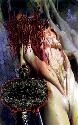 Download Vomitoma, Urinary Tract Infection From Severe Pus Clots - Vomitoma UTIFSPC