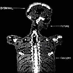 Download Disnihil - Future Cancers